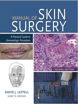 cover image of Manual of Skin Surgery